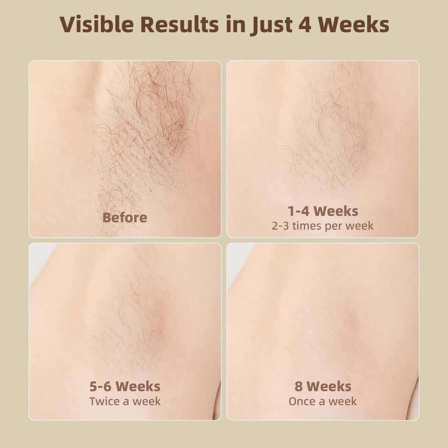 Laser Hair Removal for Women &amp; Men,  999,999 Flashes Hair Remover Device for Armpits Legs Arms Bikini Line, White