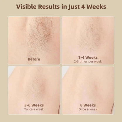 Laser Hair Removal for Women &amp; Men,  999,999 Flashes Hair Remover Device for Armpits Legs Arms Bikini Line, White